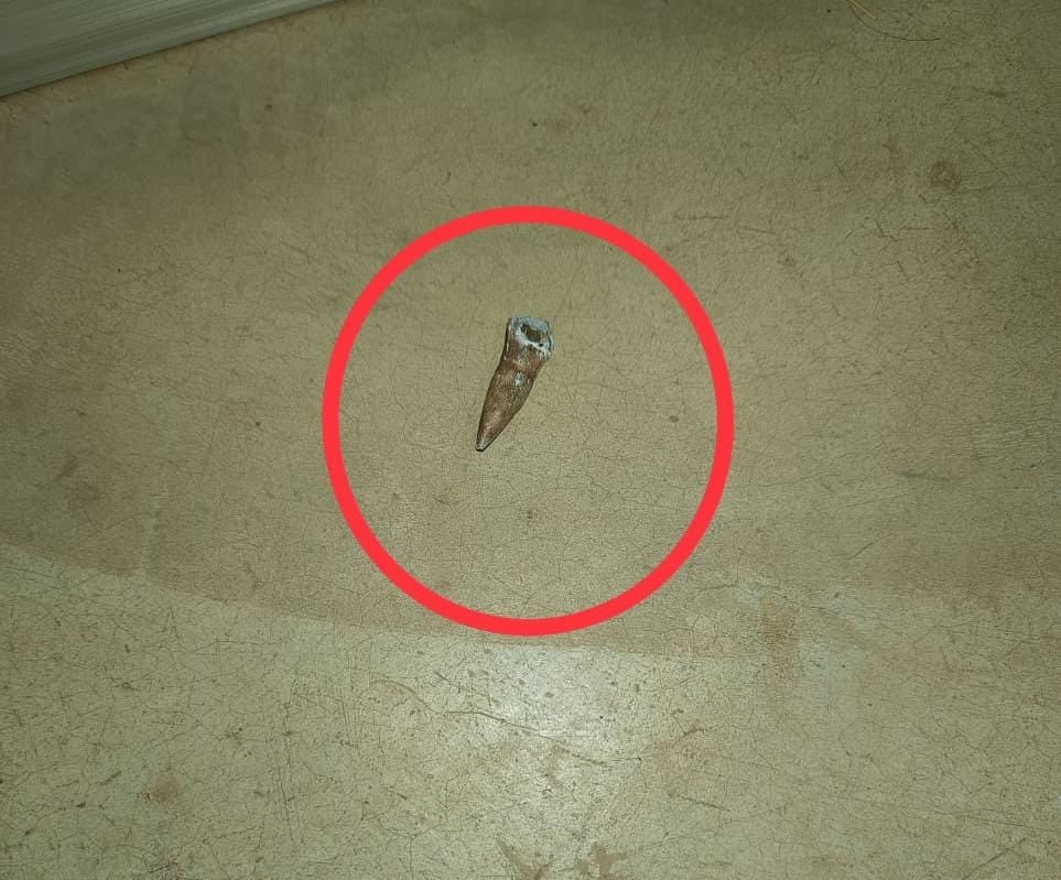 देवघर में आपसी दुश्मनी में चली गोली, बाल-बाल बचा युवक, आरोपी फरार