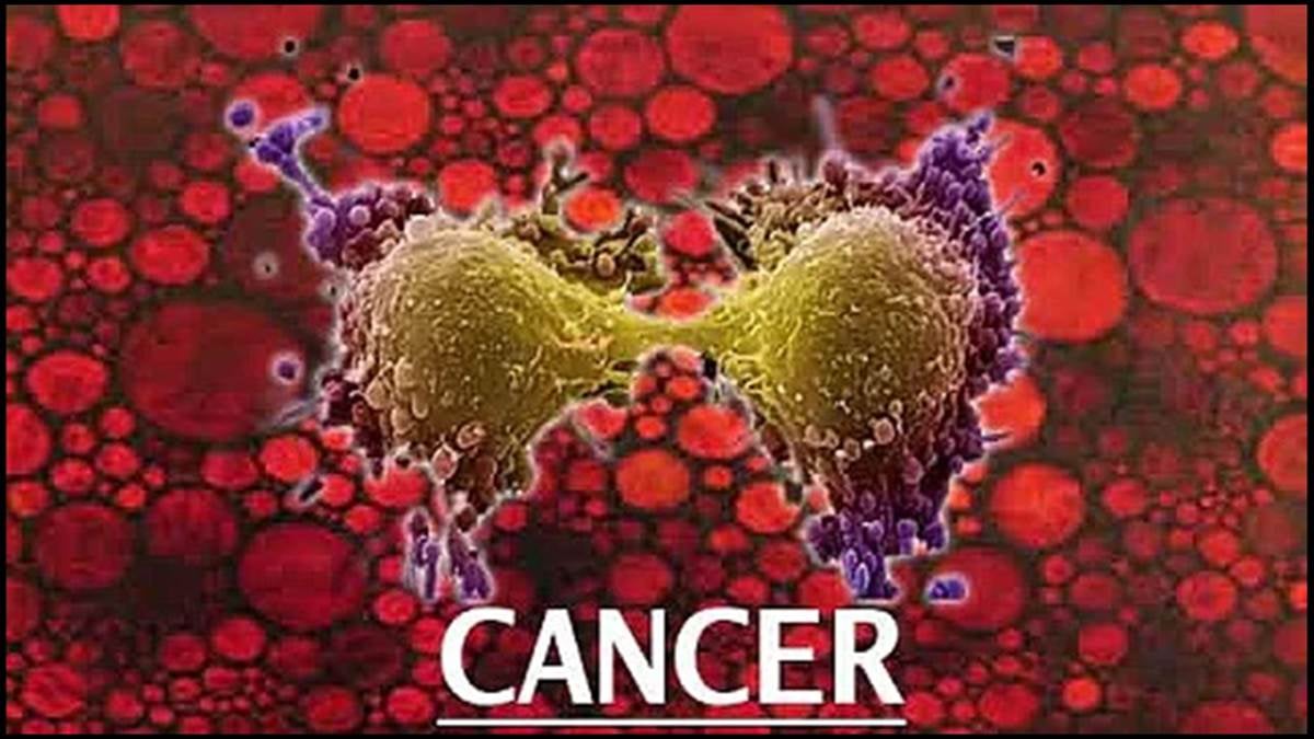 National Cancer Awareness Day: जानिए कैंसर को 4 स्टेज में क्यों बाटा गया, हर स्टेज में मरीज के शरीर में ऐसे होता है बदलाव