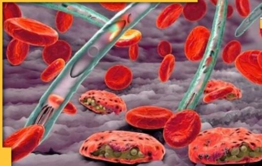 पाकुड़ के 23 गांवों में ब्रेन मलेरिया का कहर, एक ही गांव में पांच बच्चों की मौत, जानिये कैसे आम मलेरिया से अलग होता है ब्रेन मलेरिया