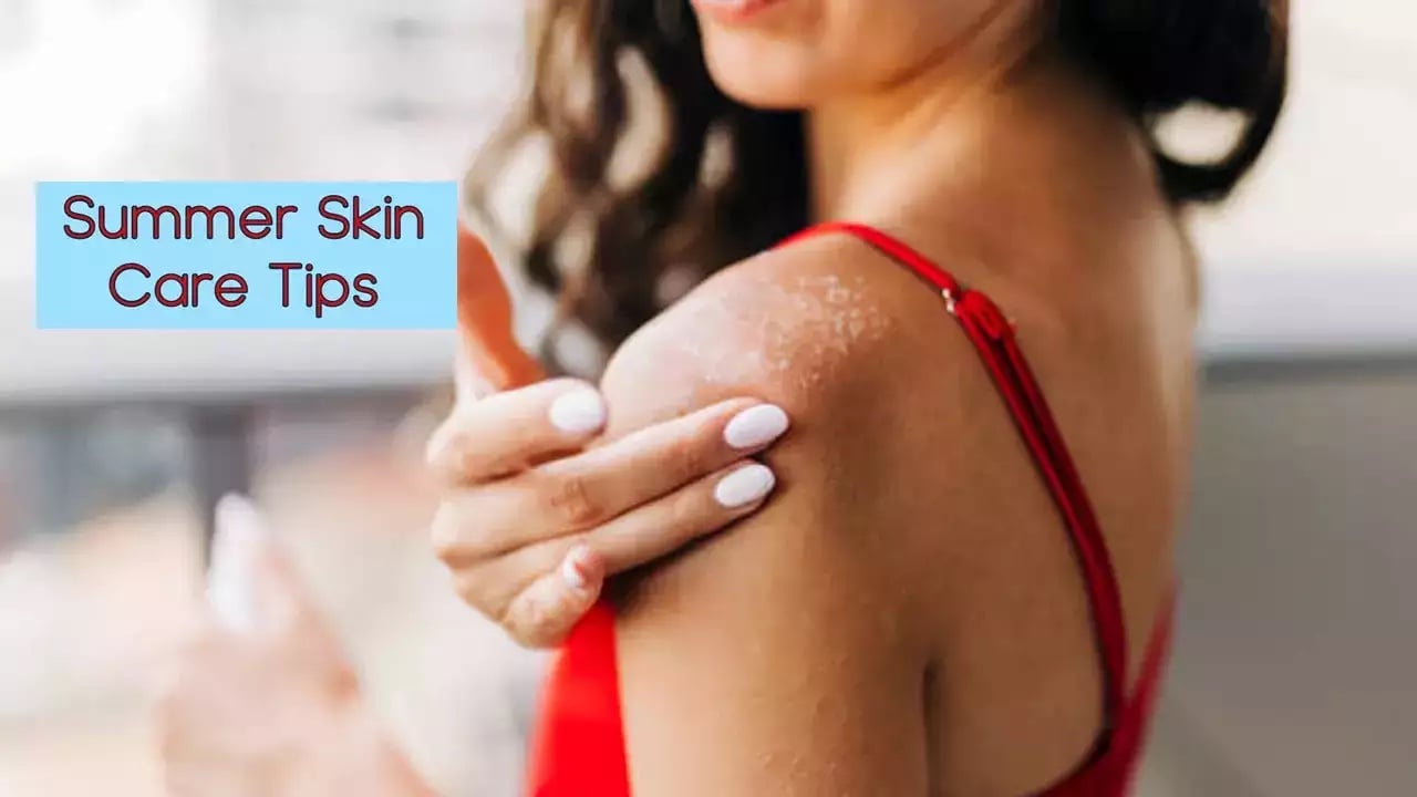 Summer Skin Care Tips: गर्मियों में हो रही स्किन एलर्जी की समस्या तो इन 5 टिप्स से मिलेगा निजात