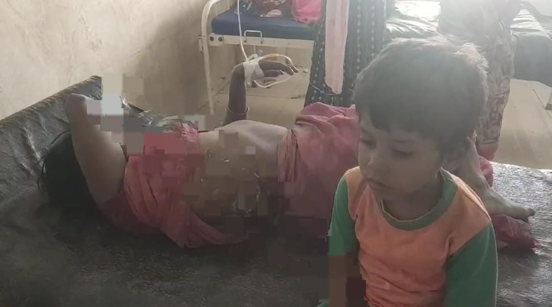 Bihar Breaking: बेतिया में मां बेटी पर तेजाब से हमला, दोनों की हालत गंभीर