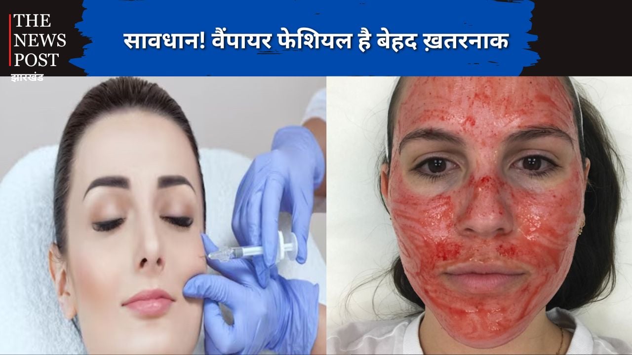 आजकल खूब ट्रेंड में है "वैंपायर फेशियल", जानिए लोग क्यों करवाते हैं ये फ़ेशियल और ये कितना है ख़तरनाक