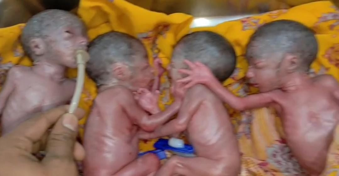 अजब गजब! बिहार की इस महिला ने एक साथ 5 बच्चियों को दिया जन्म, खबर सुनते ही परिजन हैरान