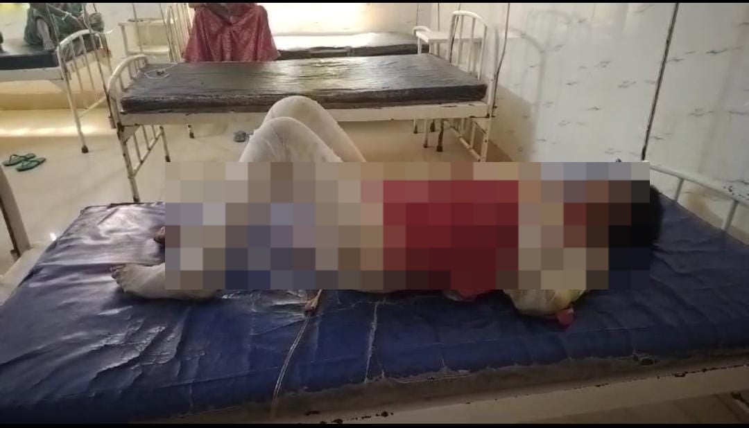 गोड्डा में रिश्तों का कत्ल: हैवान पति ने घर में सो रही पत्नी और साली पर पेट्रोल छिड़क लगाई आग, आठ माह की गर्भवती पत्नी की मौत