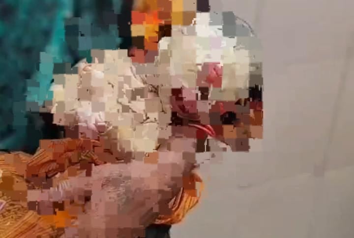 एलियन या भगवान का अवतार! महिला ने दिया अजीबों-गरीब बच्चे को जन्म, डॉक्टर भी हुए हैरान, दूर दूर से देखने के लिए जुट रही भीड़