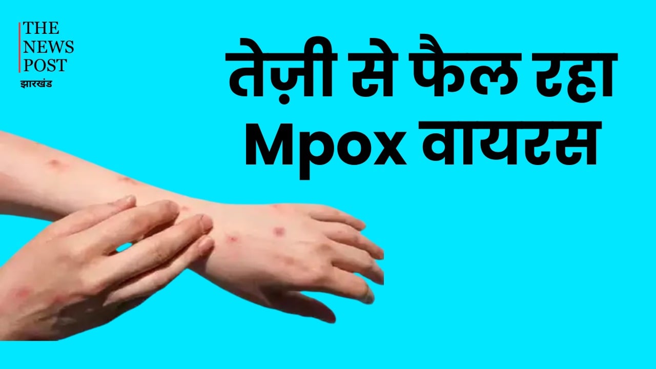 बारिश के बीच तेजी से फैल रहा है खतरनाक मंकीपॉक्स (MPOX) वायरस, जानिए क्या हैं इसके लक्षण