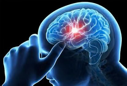 Health: ठंड बढ़ते ही ब्रेन हेम्ब्रज का बढ़ा मामला, 3 दिनो में 35 मरीज पहुंचे अस्पताल, लक्षण दिखते ही हो जाएं सावधान