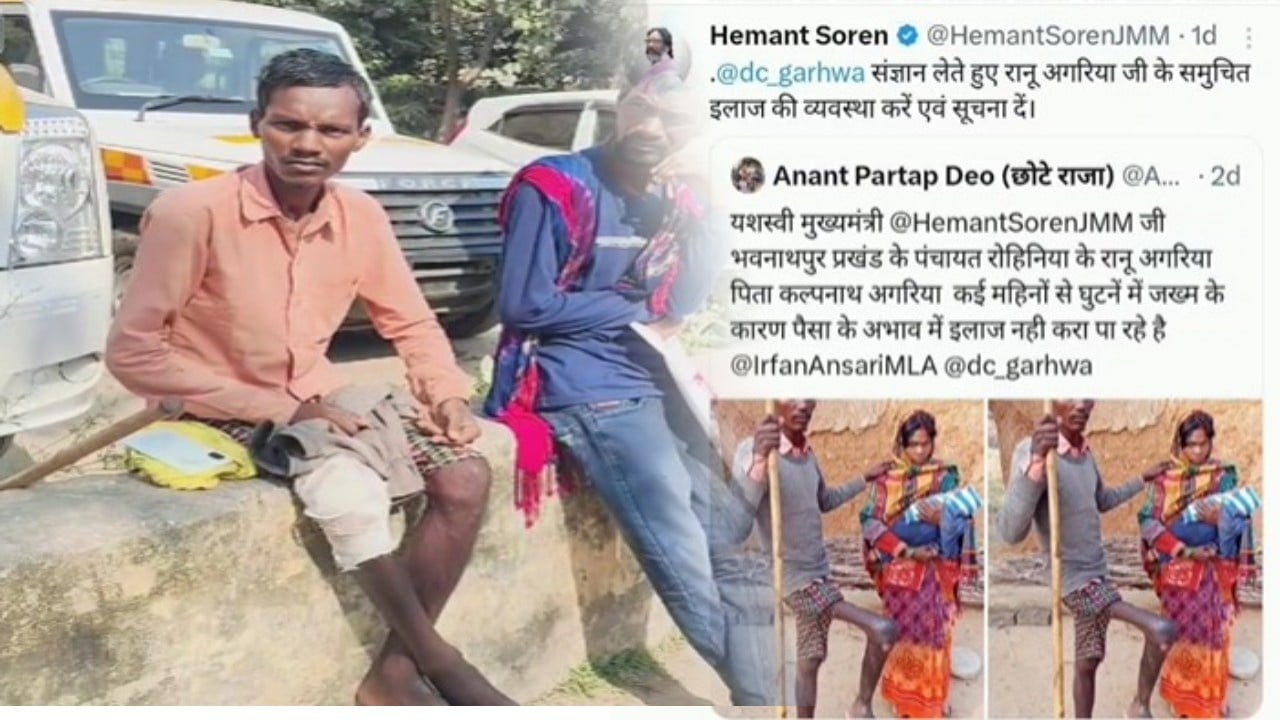 मुख्यमंत्री के आदेश की हो रही अनदेखी, घायल रानू अगरिया इलाज के लिए भटकने को हो रहे मजबूर