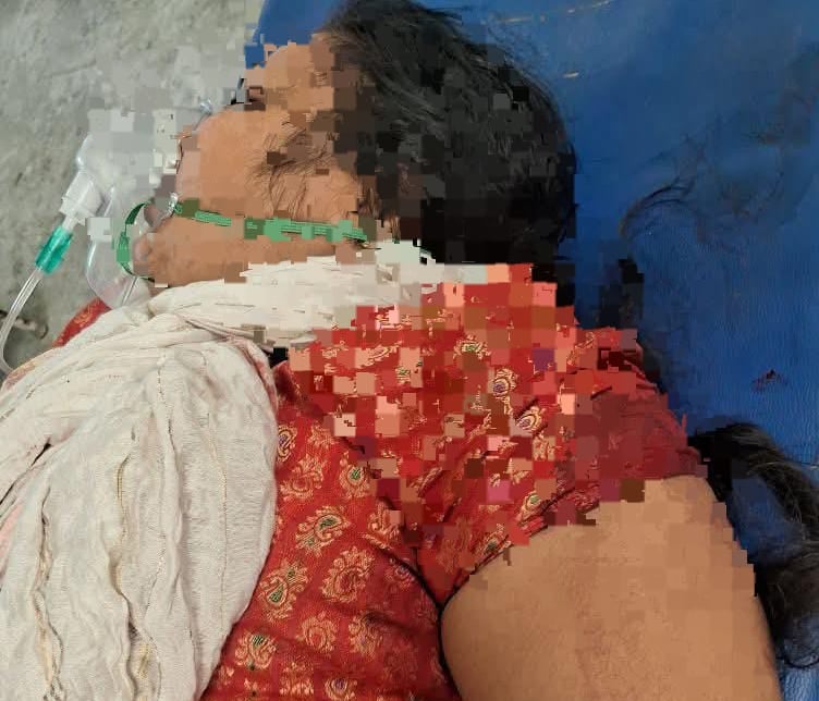 BREAKING: गोलियों की तड़तड़ाहट से सहमा पटना, बाईक सवार अपराधियों ने जदयू नेत्री को मारी गोली, हालत गंभीर