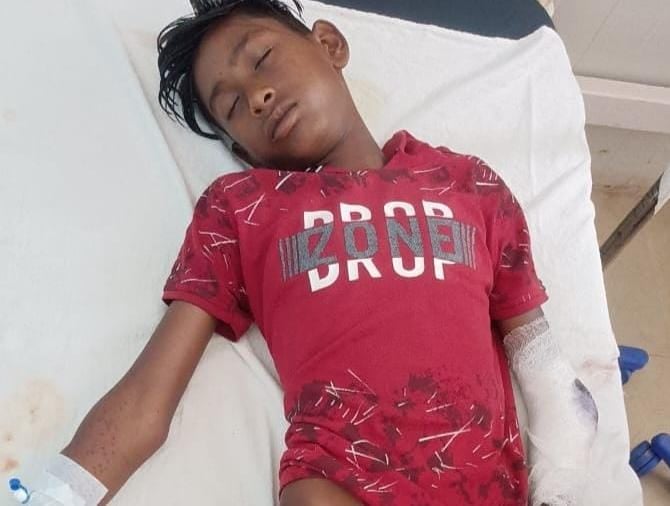 खूंटी: घर के बाहर खेल रहे नाबालिग को बदमाशों ने मारी गोली, जानें फिर क्या हुआ