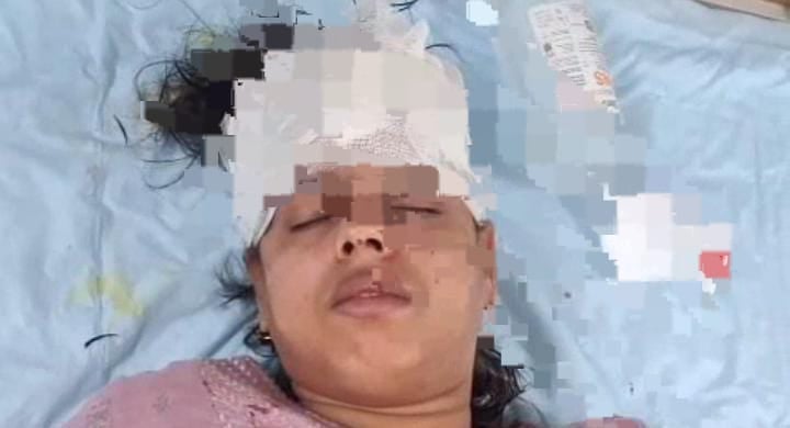 महिला से बीच सड़क चेन स्नैचिंग कर रहे थे बदमाश, लेकिन किसी ने नहीं की मदद, छीना झपटी में हुआ ये हाल