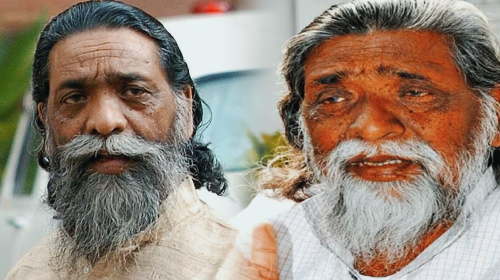 गुरु जी की सेहत में सुधार, वीडियो कॉल के जरिए विदेशी डॉक्टर कर रहें मॉनिटर, दिल्ली में जारी है इलाज