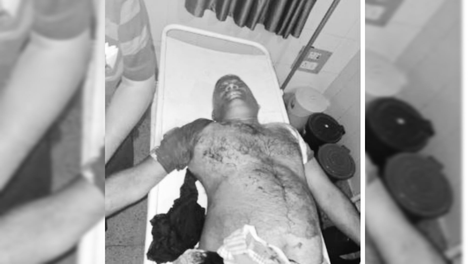 गोलियों की तड़तड़ाहट से गूंजा पलामू के ये इलाका, अपराधियों ने पारा शिक्षक को मारी 3 गोली