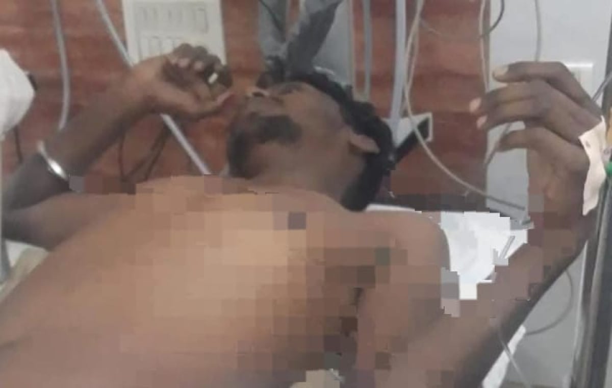 सरायकेला के आदित्यपुर में दो गुटों में खूनी संघर्ष, एक को लगी गोली, हालत गंभीर