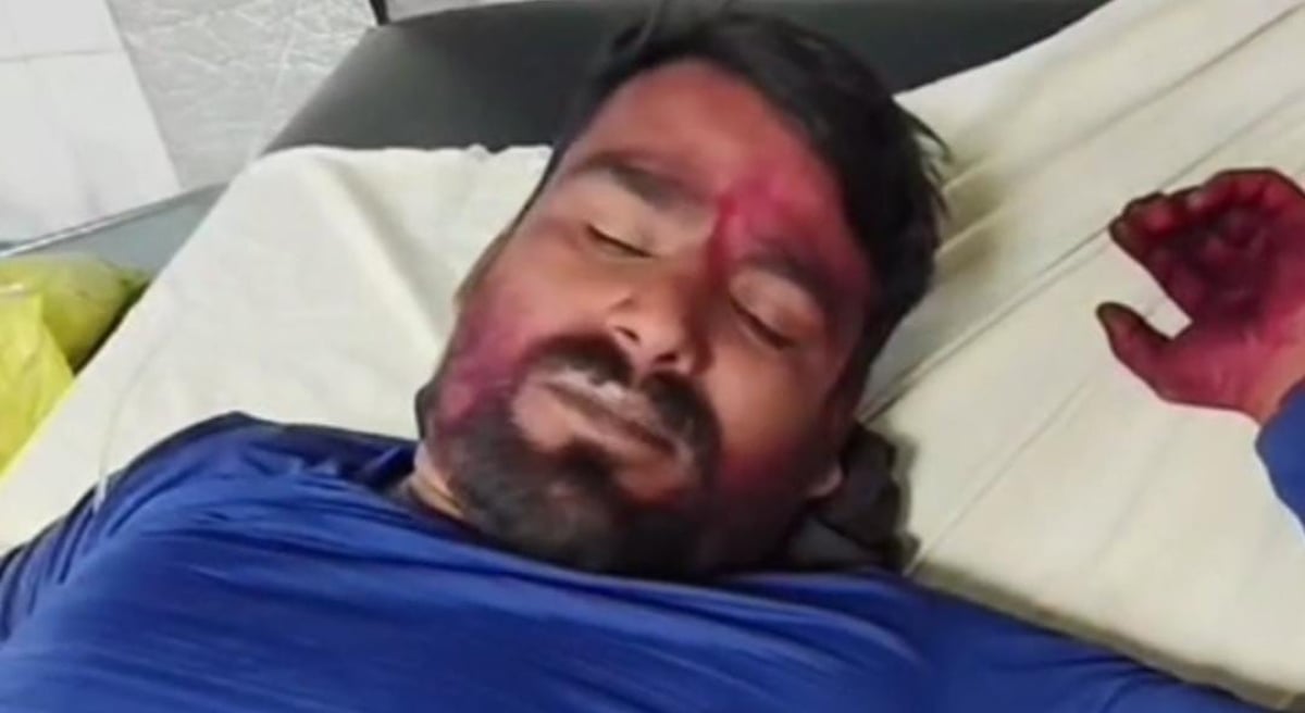 धनबाद:डीजे बजाने को लेकर हुआ विवाद फायरिंग तक पहुंचा, दो युवकों की हालत गंभीर