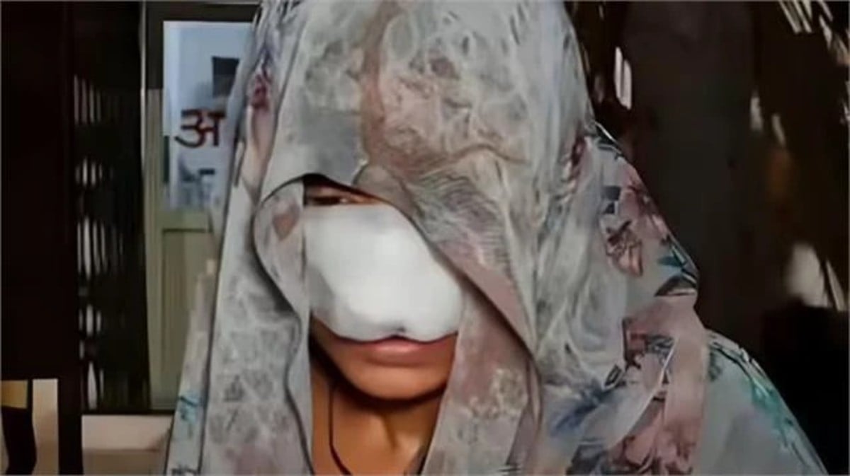 ये कैसी दरिंदगी? पति ने पत्नी की चबा डाली नाक, यहीं नहीं रुकी हैवानियत और कर दिया ऐसा कांड...