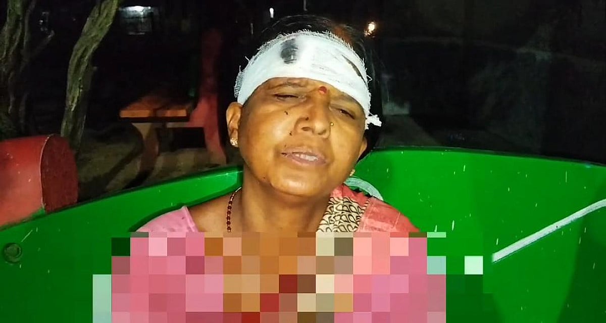 घर में घुस कर बेटी के साथ छेड़खानी,विरोध करने पर माँ को लोहे के रोड से पीटा,जांच में जुटी पुलिस