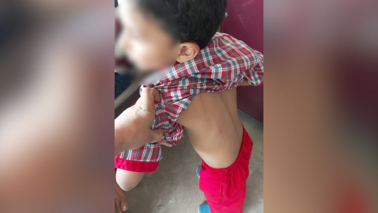अरोड़ा स्कूल के टीचर ने मासूम छात्र  की बेरहमी से की पिटाई, परिजनों ने दर्ज की शिकायत