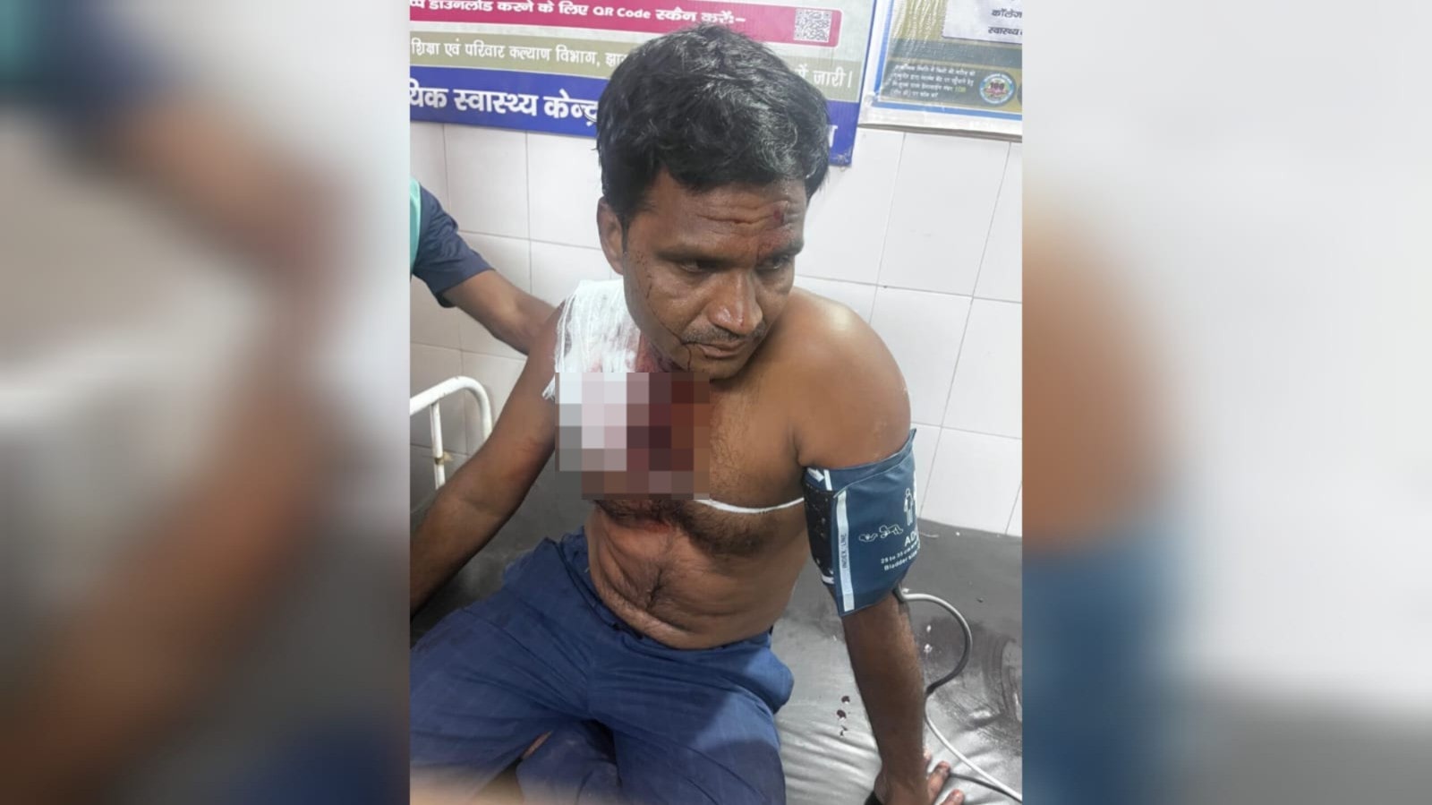 दुमका में आपसी विवाद ने लिया खूनी मोड़, बकरी व्यापारी के सीने में मारी गोली, हालत गंभीर