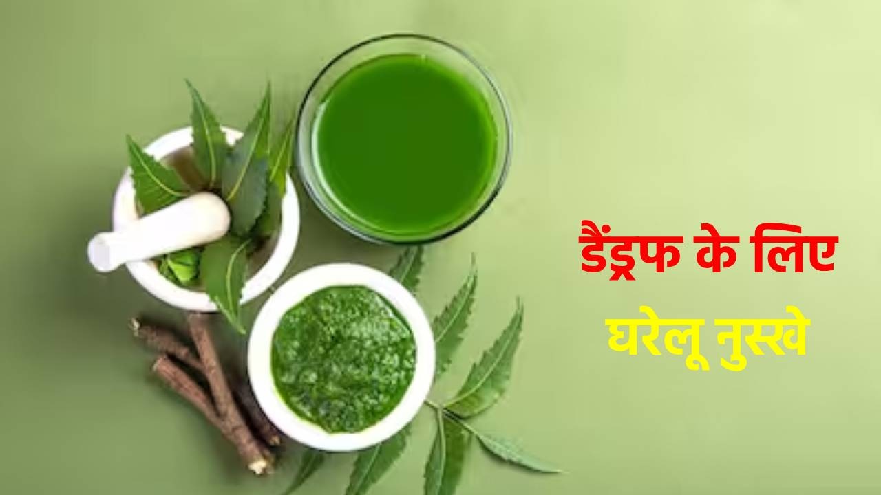 सर्दियों में बढ़ गए हैं जिद्दी डैंड्रफ, महंगे प्रोडक्टस की जगह अपनाएं ये 5 घरेलू नुस्खे, जल्द दिखेगा रिजल्ट