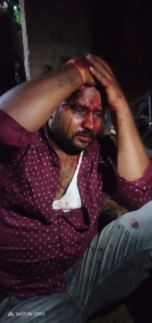 देवघर : पुनासी पंचायत के मुखिया प्रत्याशी पर जानलेवा हमला