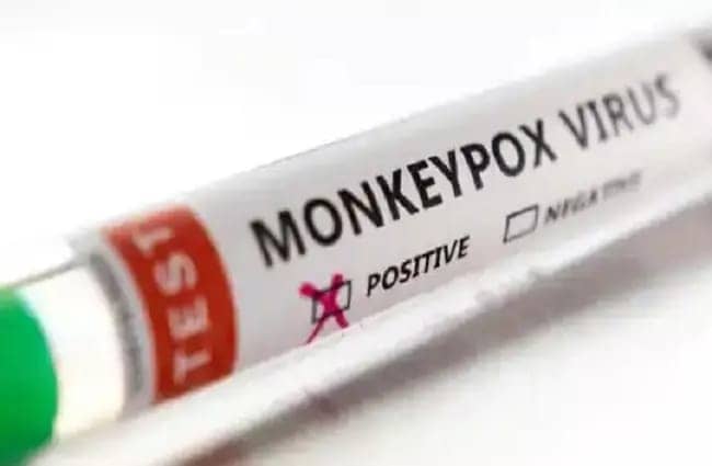 न्यूयार्क में मंकीपॉक्स को लेकर हेल्थ इमरजेंसी घोषित