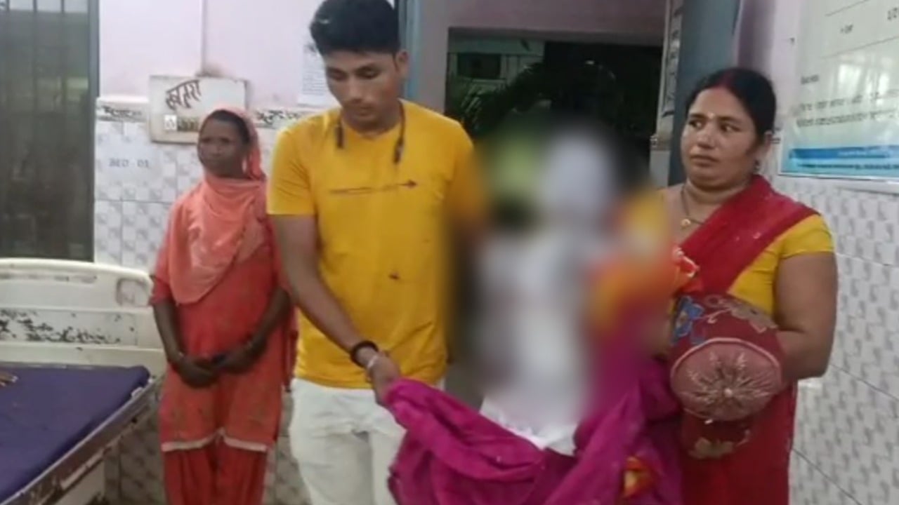 गैस रिसाव से तीन घरों में लगी आग, 6 माह की बच्ची समेत 6 लोग झुलसे