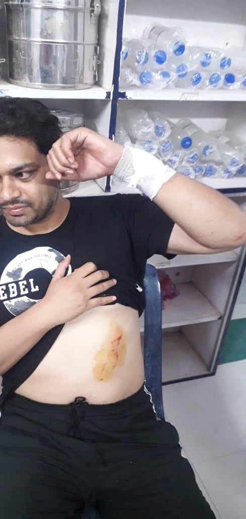 गोड्डा विधायक हमला कांड : आने जाने की थी रेकी, पूरी तैयारी के बाद आए थे हमलावर, जानिए किस पर शक की सूई