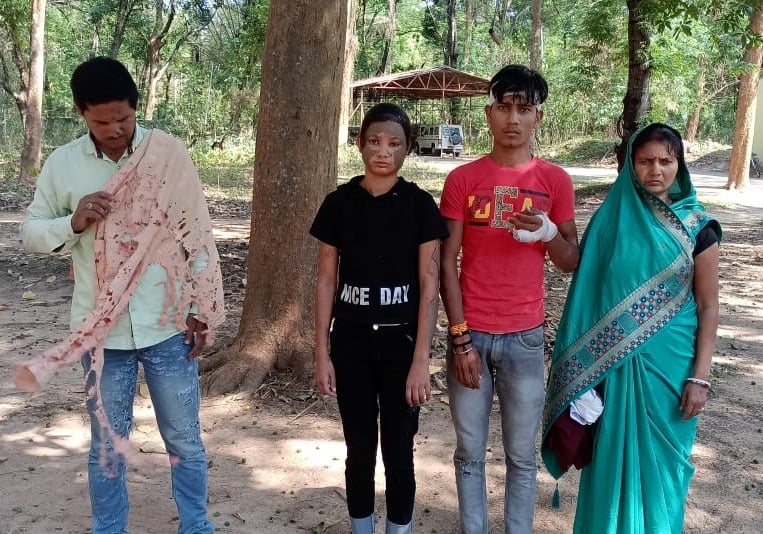 तेजाब कांड के पीड़ित ने एसपी से लगायी न्याय की गुहार, जान से मारने की मिल रही है धमकी