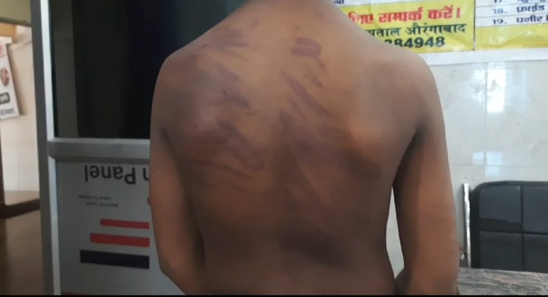 सवाल पूछने पर निजी कोचिंग का टीचर बना हैवान, छात्र को तांबे के तार से पीटा
