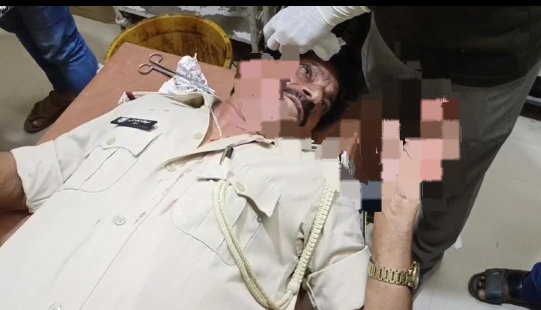 बिहार में आम आदमी के साथ पुलिस भी नहीं है सुरक्षित, पढ़े कैसे जहानाबाद में दारोगा पर हुआ जानलेवा हमला