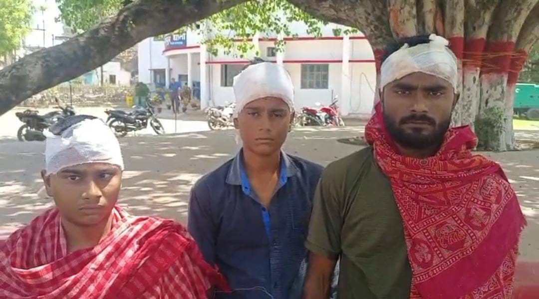 देवघर: दबंगों ने एक ही परिवार के 3 भाइयों पर किया जानलेवा हमला, सभी घायल, पढ़ें रंजिश की वजह