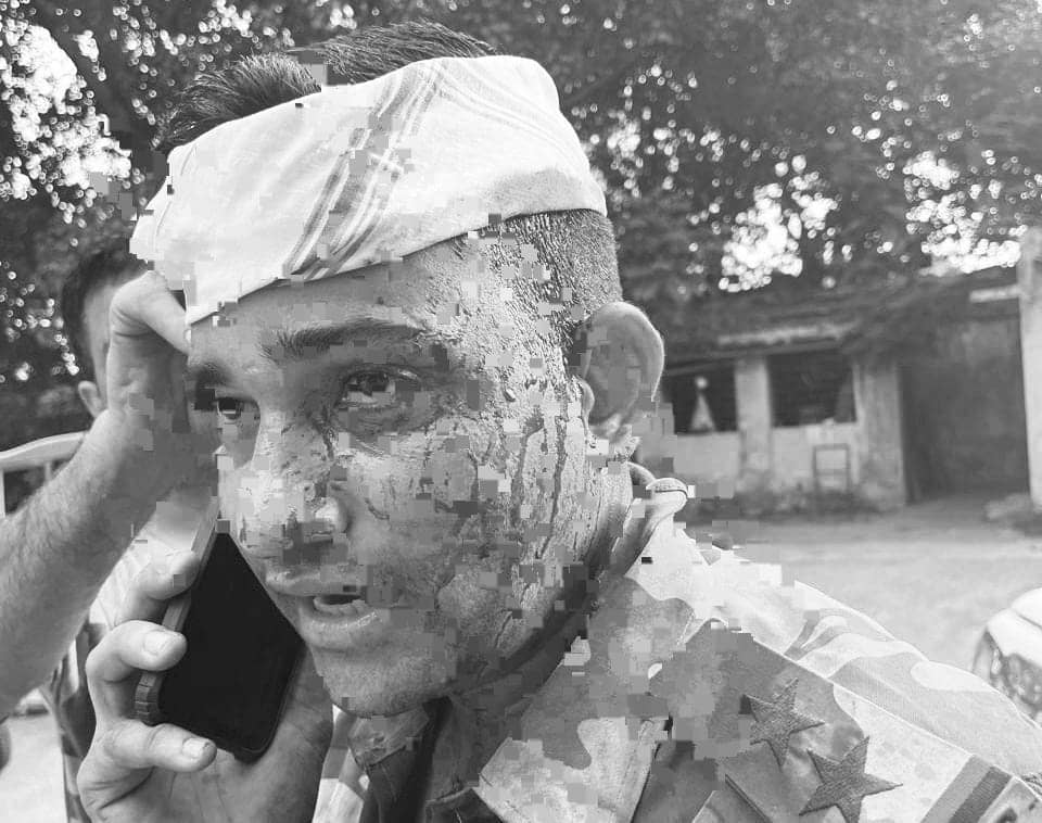 देवघर में दिखी कोयला चोरों की दबंगई! चोरों ने CISF इंस्पेक्टर को किया लहूलुहान, पढ़ें पूरा मामला