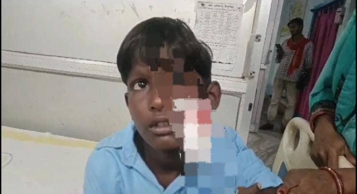 बेगूसराय में अवारा कुत्ते के आतंक से लोग परेशान, अब तक 30 लोगों को बना चुका है अपना शिकार,लोगों में फैला खौफ