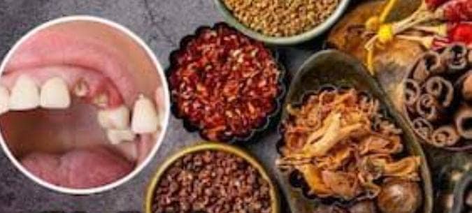 दांत दर्द के साथ कई गंभीर बीमारियों के लिए रामबाण है रसोई में रखा ये मसाला,इस्तेमाल से छू मंतर हो जाती है बीमारी