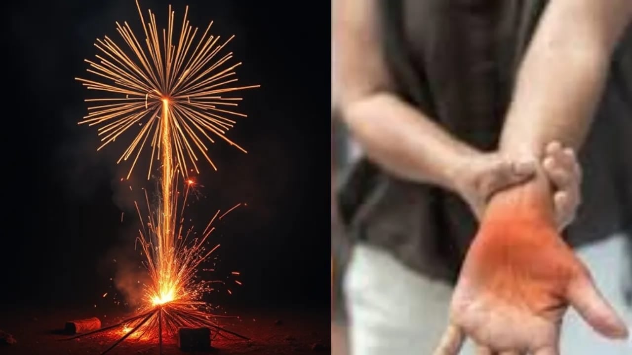 Diwali 2025: दीवाली में पटाखे जलाते समय इन बातों का रखें ध्यान, अगर जल जाए हाथ तो तुरंत करें ये काम